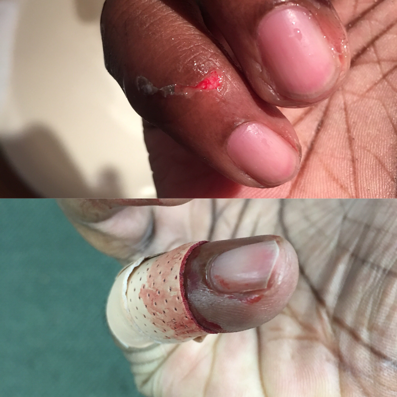 Illustration for article titled My Mustang went slightly C&C on my finger today